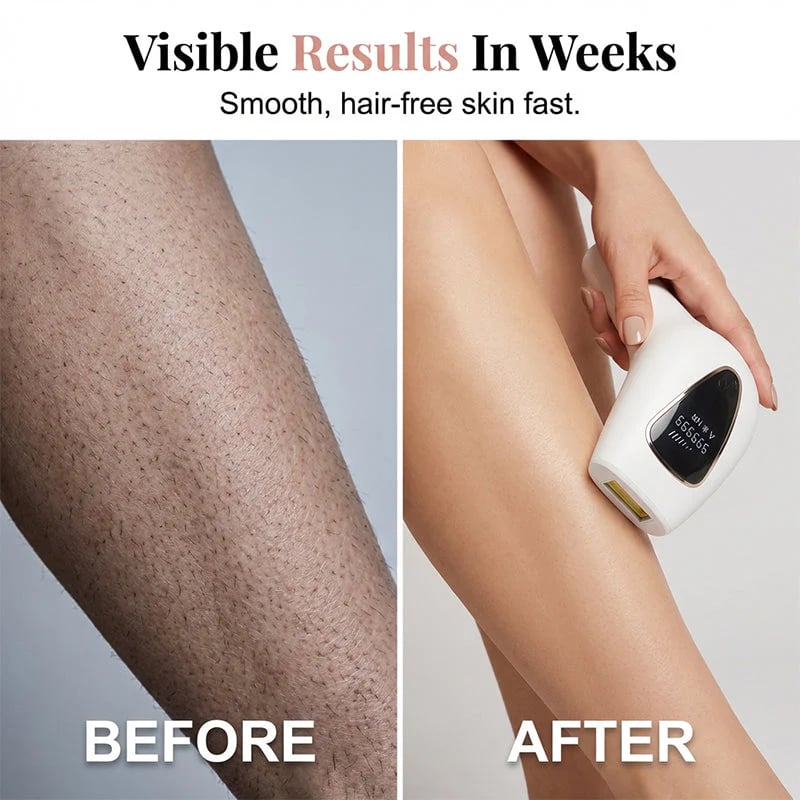 Painless Ipl Hair Removal Device for Women
