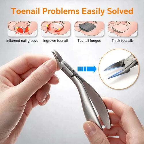 🦶 Limited-time 40% Off! ⚡ Stainless Steel Ingrown Toenail Clipper Set – Precise, Sturdy, Portable ✨