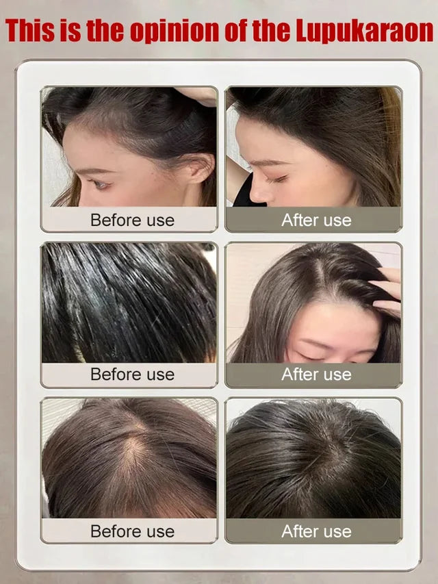 Clinical-grade anti-hair loss