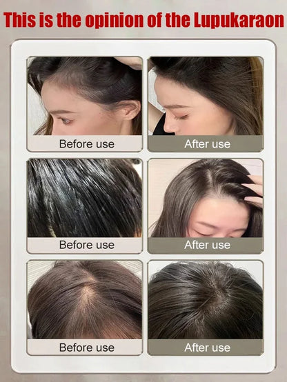 Clinical-grade anti-hair loss