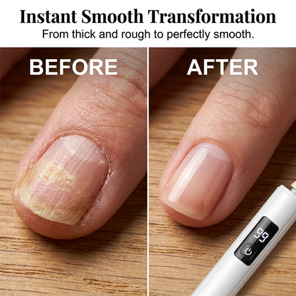 ✨❤️Professional Electric Nail Polisher