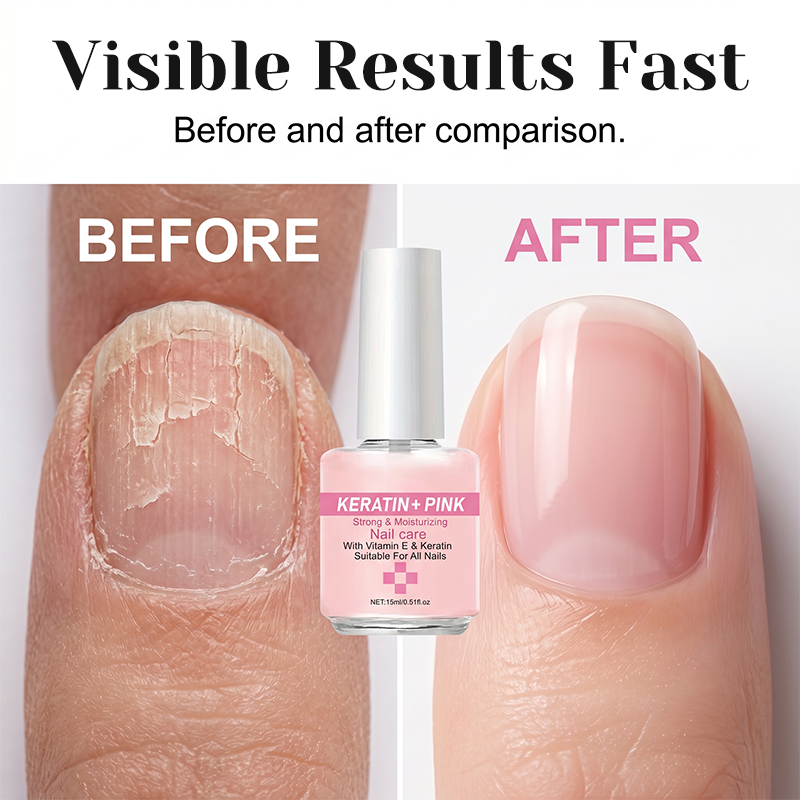 💅 Keratin Nail Strengthener & Moisturizer – Repair & Glossy Finish 🌟