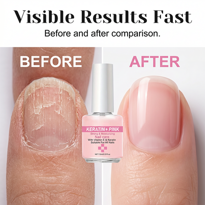 💅 Keratin Nail Strengthener & Moisturizer – Repair & Glossy Finish 🌟